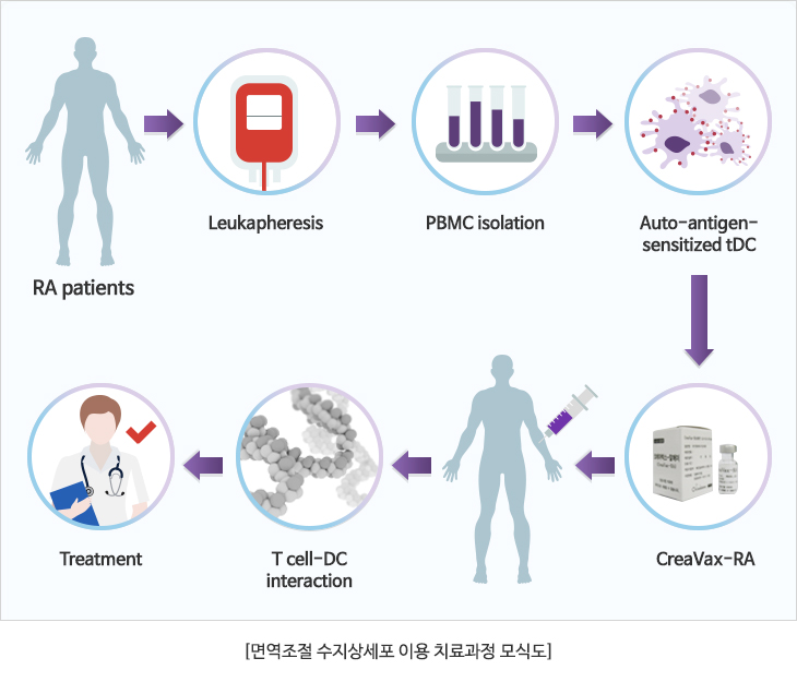 면역조절 수지상세포 이용 치료과정 모식도